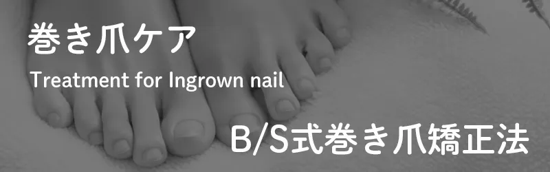巻き爪ケア