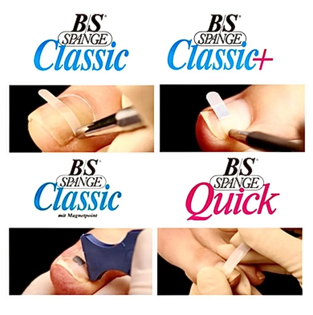 ドイツBSスパンゲ 新品巻爪矯正プレート10枚 多摩エリアの巻き爪矯正なら「ななスキンケア皮膚科クリニック